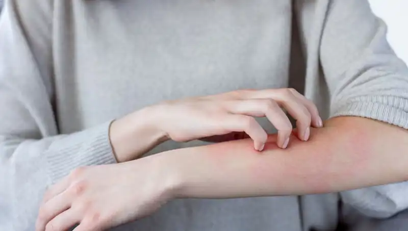 Cilt Kanserinin Gözden Kaçan İki Belirtisi: Dermatologlar Uyardı