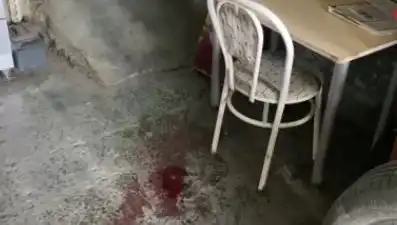 Sandalyeden Düşen Adamın Talihsiz Kaza, Hayatını Değiştirebilir