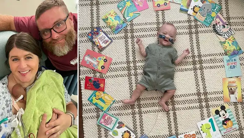 Dünyanın En Prematüre Bebeği: 280 Gram Doğdu, Hayat Mücadelesi Başladı